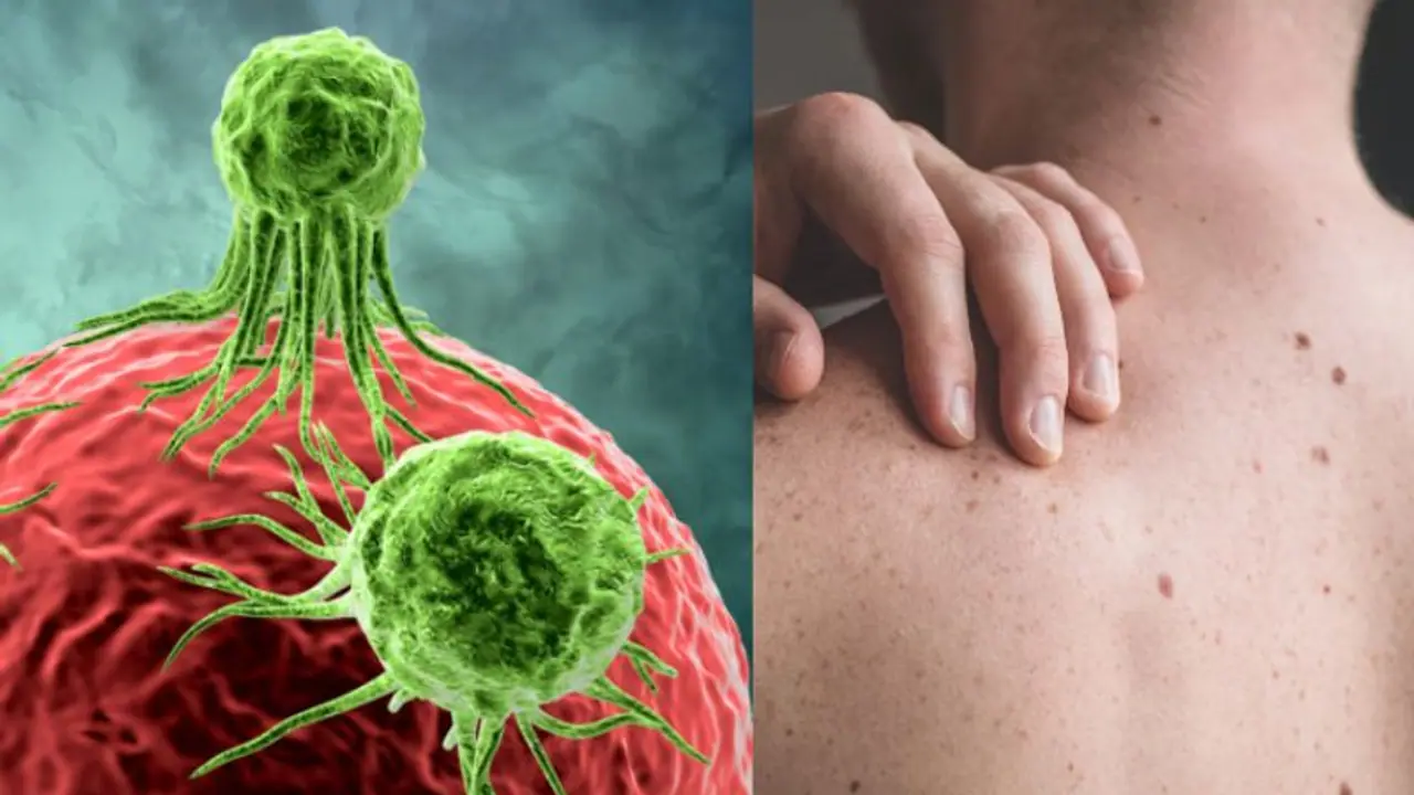 ക്യാന്‍സര്‍; ശരീരം മുൻകൂട്ടി കാണിക്കുന്ന ചില ലക്ഷണങ്ങൾ...