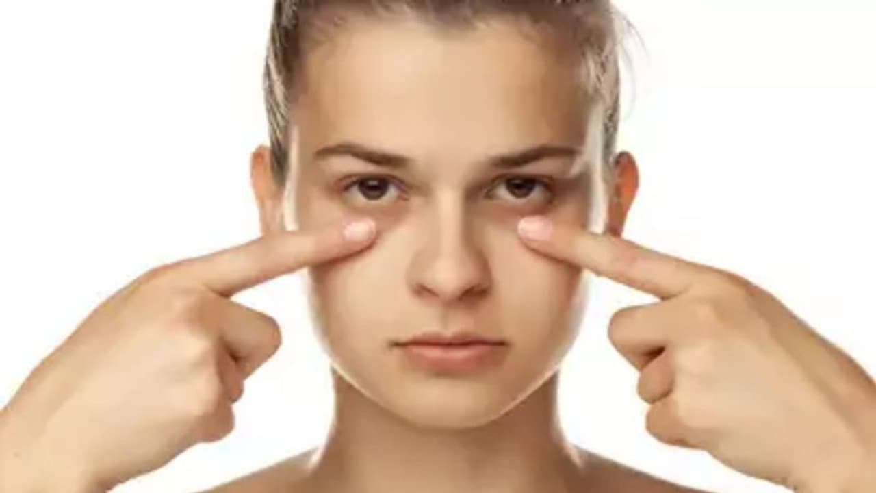 കണ്ണിന് ചുറ്റുമുള്ള കറുപ്പ് മാറാൻ പരീക്ഷിക്കാം ഈ പൊടിക്കെെകൾ