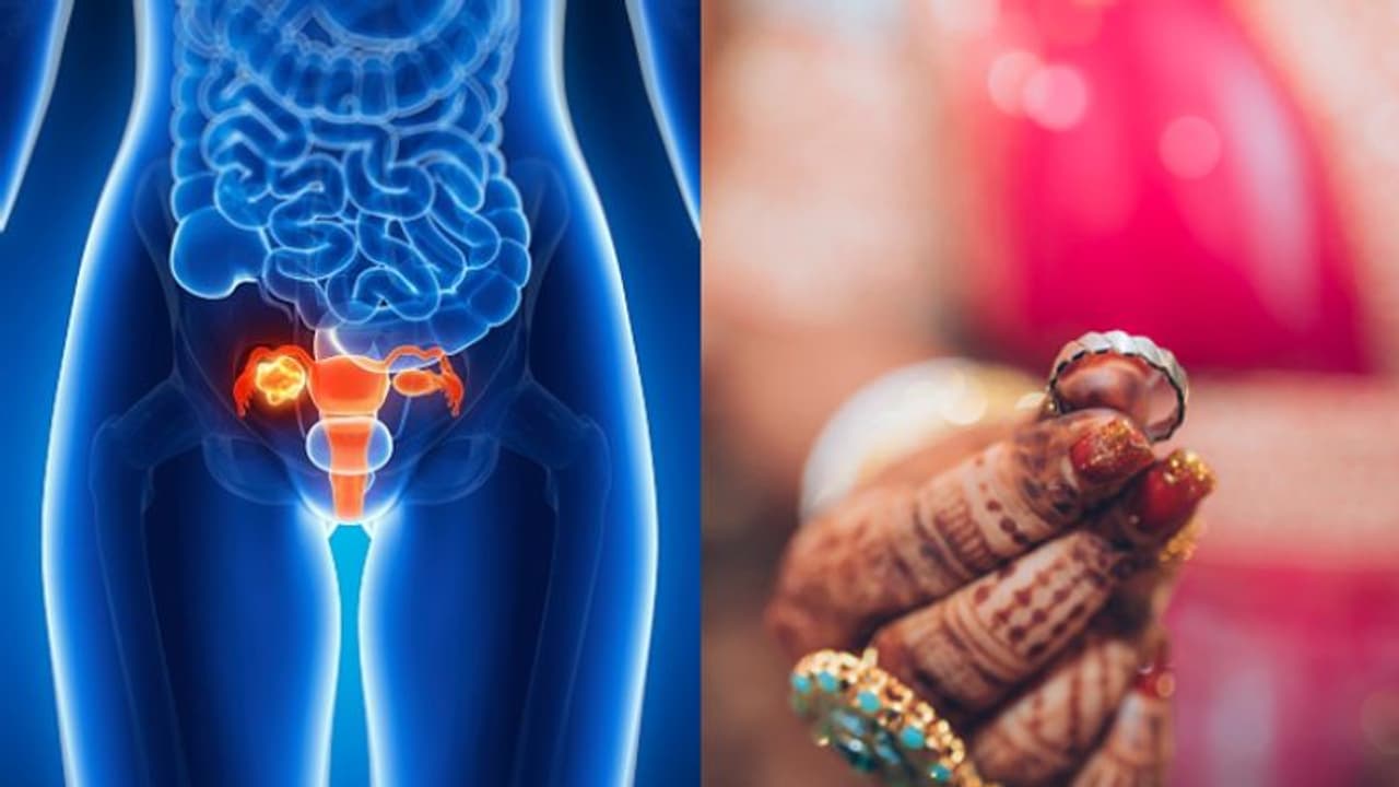 ഭാര്യക്ക് ക്യാൻസർ, ഗർഭപാത്രം നീക്കി, വിവാഹമോചനം ആവശ്യപ്പെട്ട് യുവാവ്, തള്ളി കോടതി, ബന്ധുക്കൾക്ക് രൂക്ഷ വിമർശനം