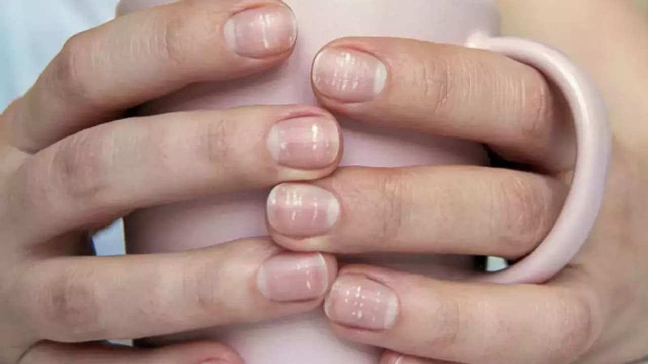 കാത്സ്യത്തിന്‍റെ കുറവ്; അറിഞ്ഞിരിക്കാം ഈ ലക്ഷണങ്ങളും കഴിക്കേണ്ട ഭക്ഷണങ്ങളും... 