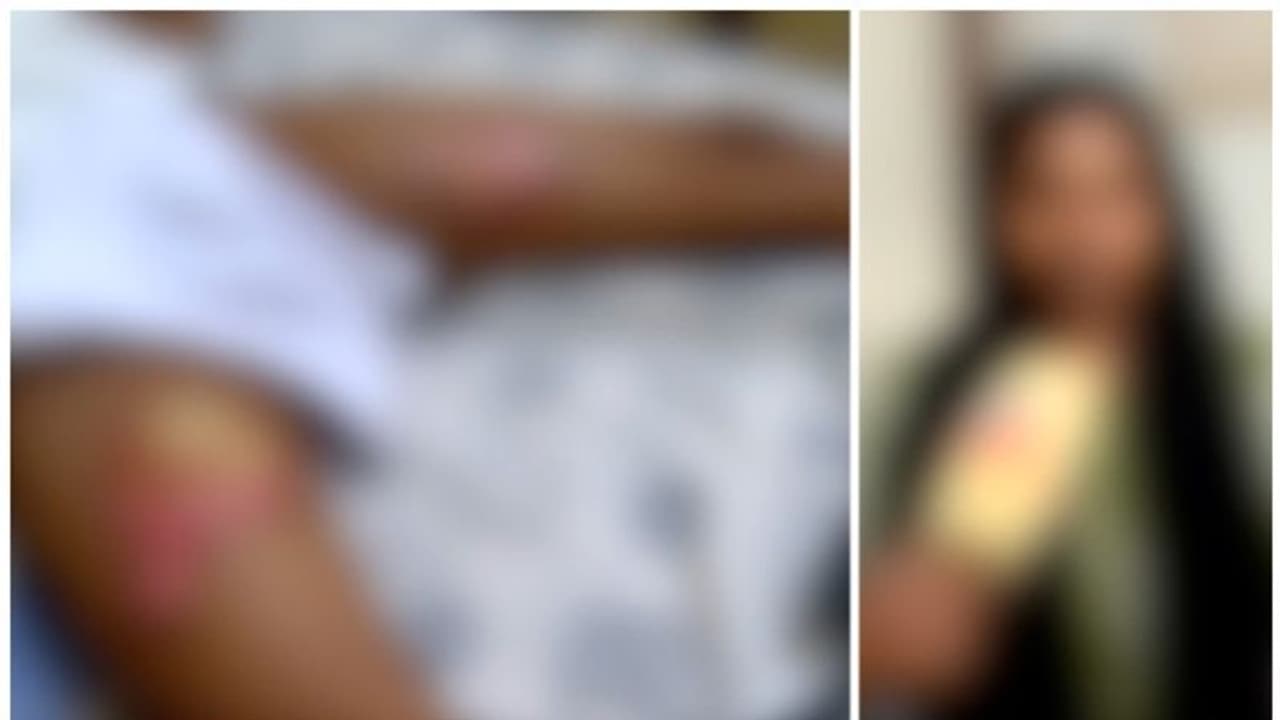 ട്രെയിനിൽ 7 വയസുകാരന് പൊള്ളലേറ്റ സംഭവം; 'പ്രാഥമിക ചികിത്സ നിഷേധിച്ചു, ഉദ്യോഗസ്ഥർ ശ്രമിച്ചത് പിഴ ഈടാക്കാൻ' ട്രെയിനിൽ 7 വയസുകാരന് പൊള്ളലേറ്റ സംഭവം; 'പ്രാഥമിക ചികിത്സ നിഷേധിച്ചു, ഉദ്യോഗസ്ഥർ ശ്രമിച്ചത് പിഴ ഈടാക്കാൻ'