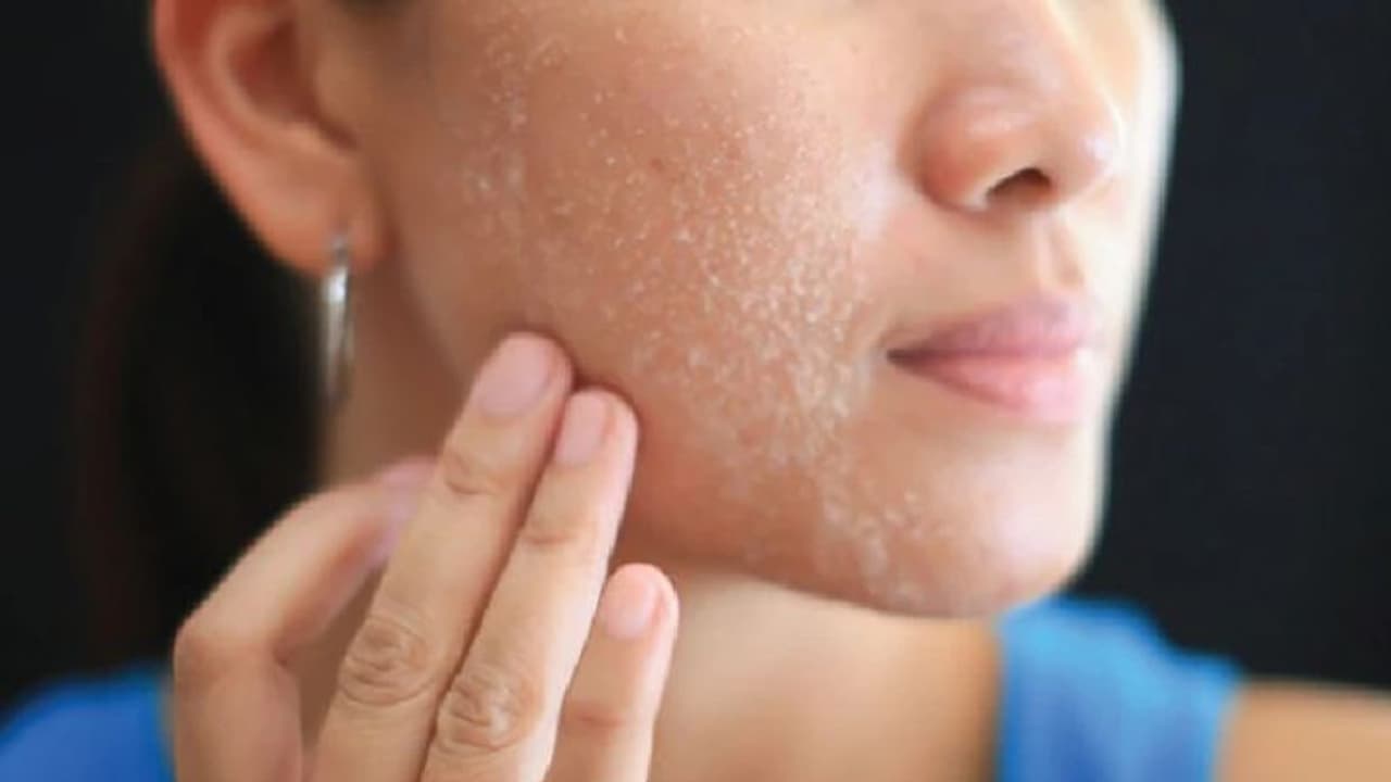 വരണ്ട ചര്‍മ്മത്തിന് വിട; സ്കിന്‍ ഈർപ്പമുള്ളതാക്കാൻ കഴിക്കാം ഈ പത്ത് ഭക്ഷണങ്ങള്‍... 