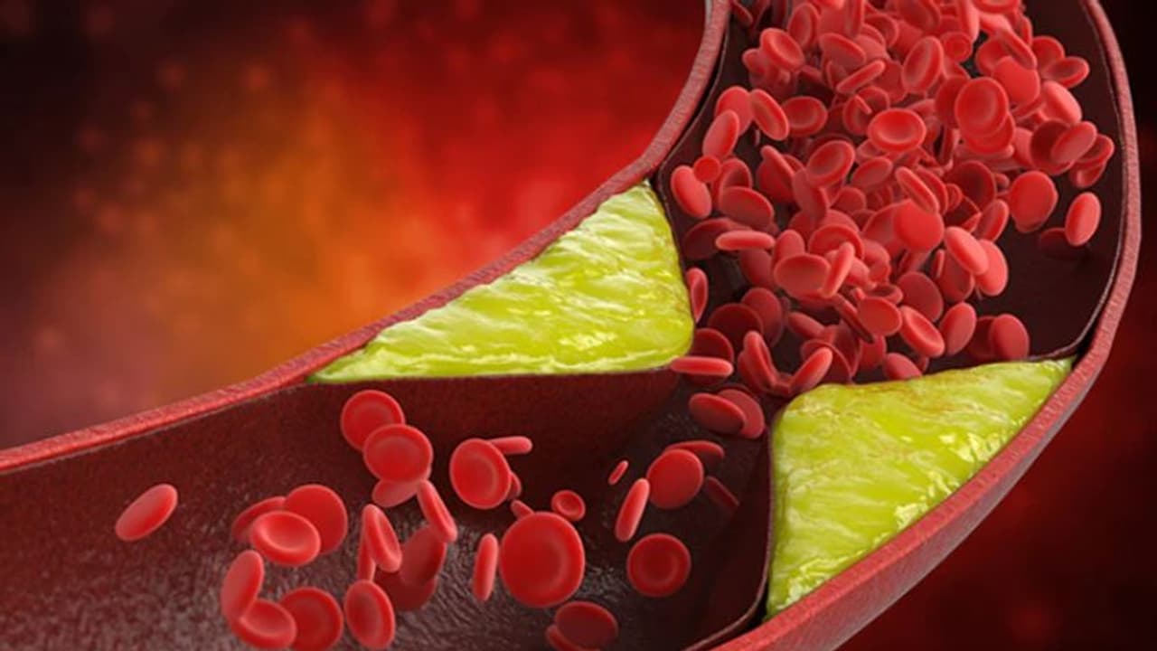 കൊളസ്ട്രോള് കുറയ്ക്കാന് കഴിക്കാം ഈ ആറ് ഭക്ഷണങ്ങള്... കൊളസ്ട്രോള് കുറയ്ക്കാന് കഴിക്കാം ഈ ആറ് ഭക്ഷണങ്ങള്...