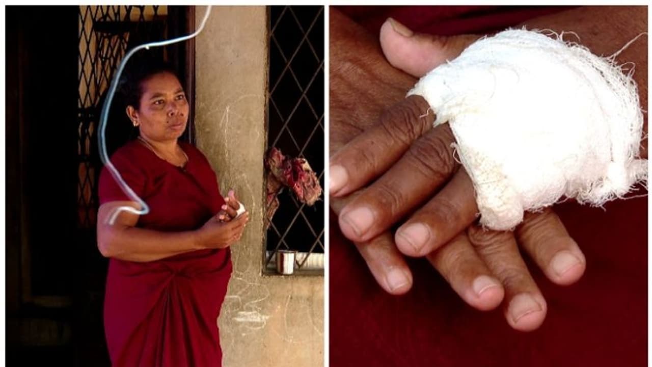 സുലോചനക്ക് ആശ്വാസം; രണ്ടരലക്ഷം നഷ്ടപരിഹാരം നൽകുമെന്ന് മന്ത്രി; വിരൽ പോയത് കാട്ടുപന്നിയുടെ ആക്രമണത്തില് സുലോചനക്ക് ആശ്വാസം; രണ്ടരലക്ഷം നഷ്ടപരിഹാരം നൽകുമെന്ന് മന്ത്രി; വിരൽ പോയത് കാട്ടുപന്നിയുടെ ആക്രമണത്തില്