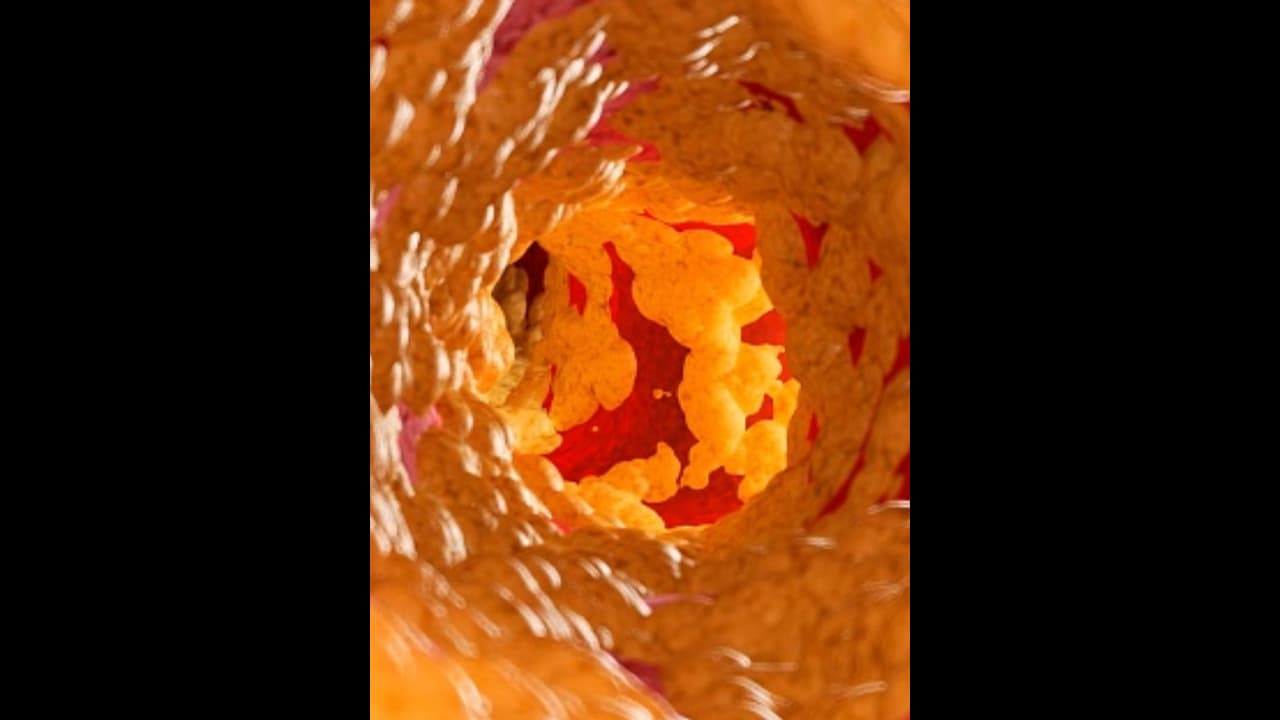 കൊളസ്ട്രോള് കുറയ്ക്കാന് ഈ ഒരൊറ്റ ഫ്രൂട്ട് പതിവായി ഇങ്ങനെ കഴിക്കൂ; അറിയാം ഗുണങ്ങള്... കൊളസ്ട്രോള് കുറയ്ക്കാന് ഈ ഒരൊറ്റ ഫ്രൂട്ട് പതിവായി ഇങ്ങനെ കഴിക്കൂ; അറിയാം ഗുണങ്ങള്...