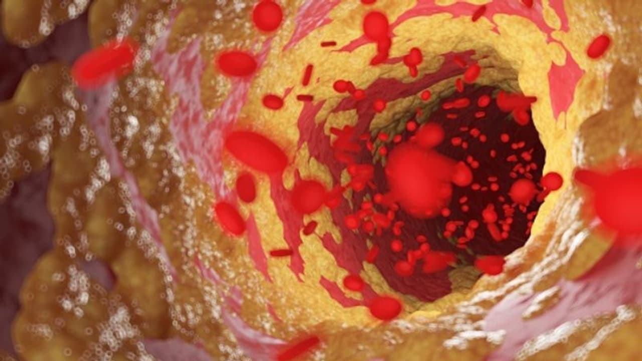 Health Tips: കൊളസ്ട്രോള് കുറയ്ക്കാന് പതിവായി കഴിക്കാം ഈ എട്ട് ഭക്ഷണങ്ങള്... Health Tips: കൊളസ്ട്രോള് കുറയ്ക്കാന് പതിവായി കഴിക്കാം ഈ എട്ട് ഭക്ഷണങ്ങള്...