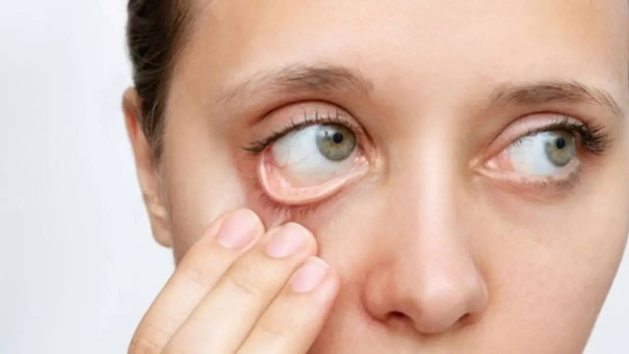 അയേണിന്റെ കുറവുണ്ടോ? ദിവസവും കഴിക്കാം ഈ ഒരൊറ്റ ഫ്രൂട്ട്... അയേണിന്റെ കുറവുണ്ടോ? ദിവസവും കഴിക്കാം ഈ ഒരൊറ്റ ഫ്രൂട്ട്...