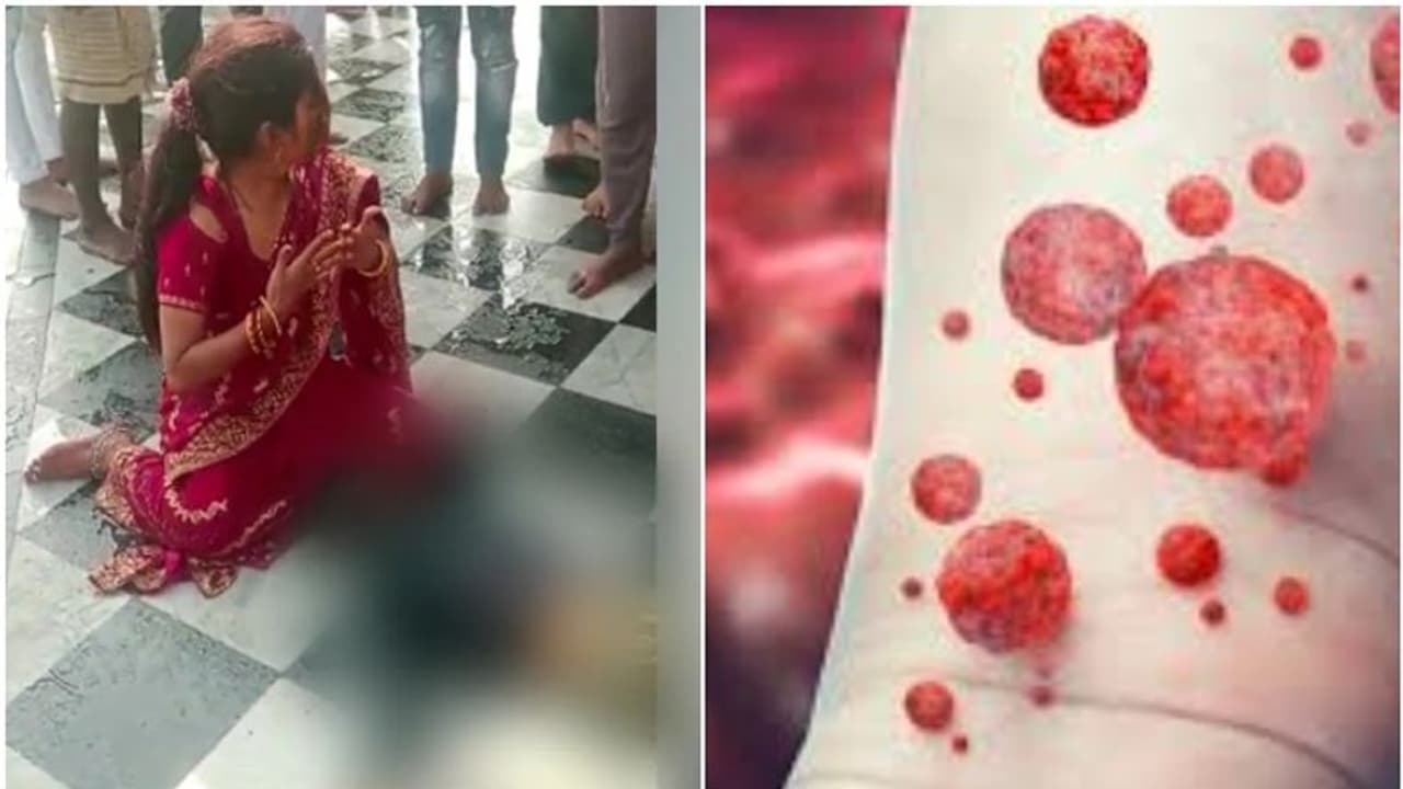 ബ്ലഡ് ക്യാൻസര് മാറാൻ ഗംഗയില് നിര്ബന്ധിച്ച് ഇറക്കി; അഞ്ച് വയസുകാരൻ മരിച്ചു ബ്ലഡ് ക്യാൻസര് മാറാൻ ഗംഗയില് നിര്ബന്ധിച്ച് ഇറക്കി; അഞ്ച് വയസുകാരൻ മരിച്ചു