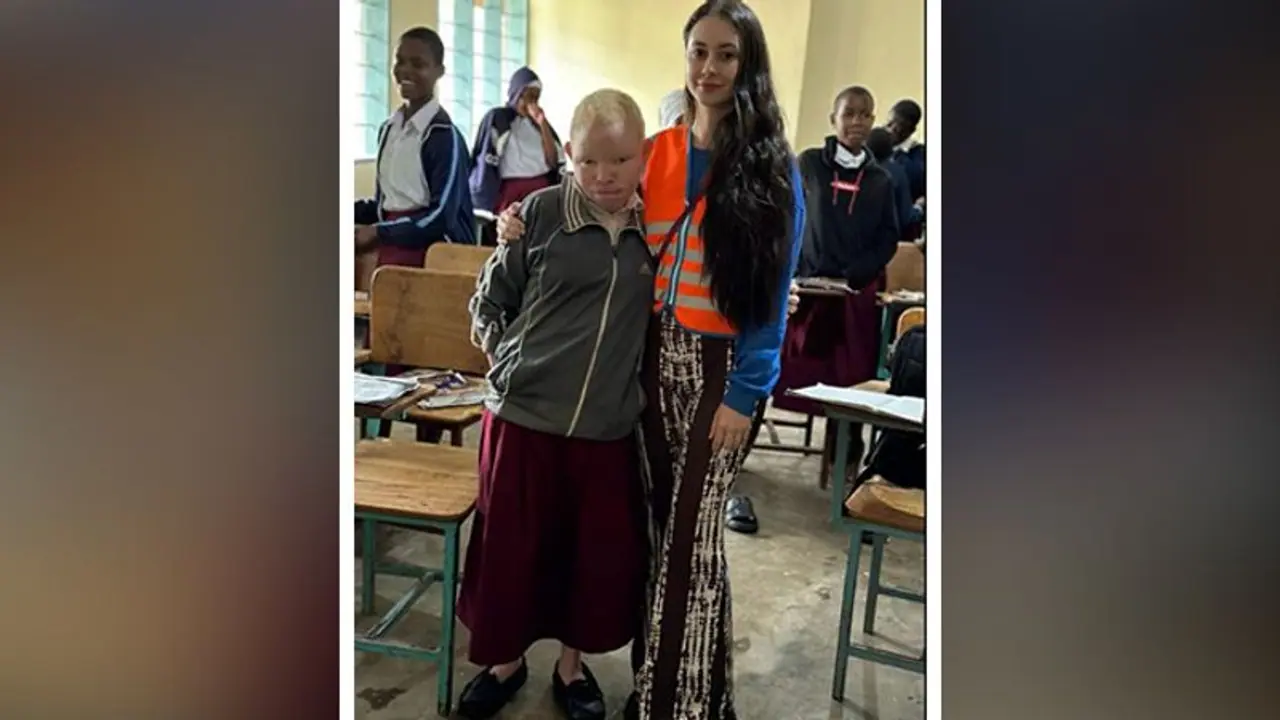 Fiona Allison's Cultural Odyssey: A French Model's Impact on Global Fashion and Social Media Fiona Allison's Cultural Odyssey: A French Model's Impact on Global Fashion and Social Media