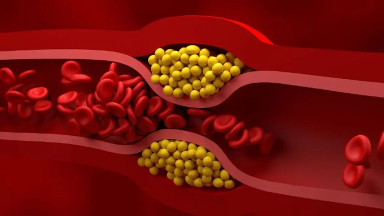 അടുക്കളയിലുള്ള ഈ രണ്ട് ചേരുവകൾ ഉപയോഗിച്ച് ചീത്ത കൊളസ്ട്രോൾ കുറയ്ക്കാം അടുക്കളയിലുള്ള ഈ രണ്ട് ചേരുവകൾ ഉപയോഗിച്ച് ചീത്ത കൊളസ്ട്രോൾ കുറയ്ക്കാം