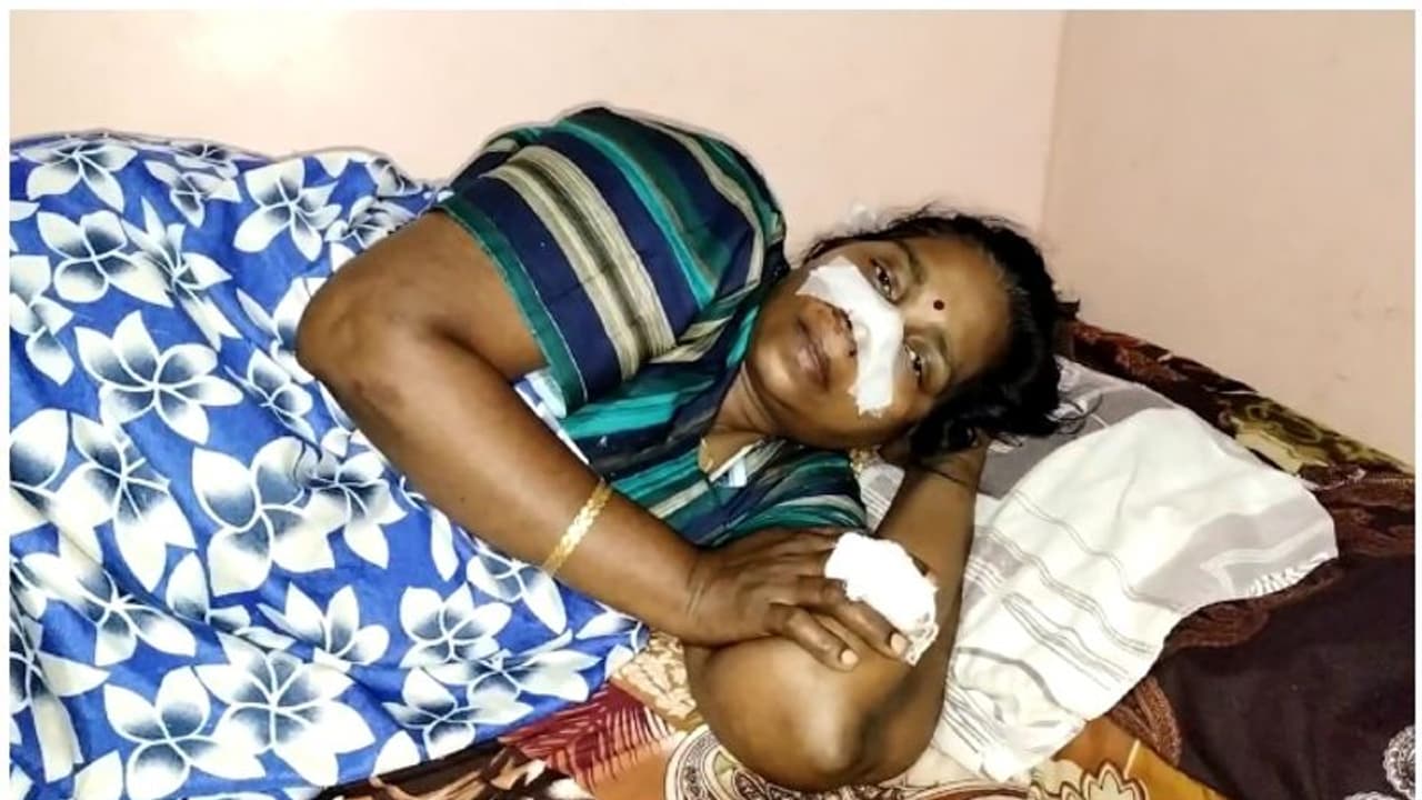 തിരുവനന്തപുരത്ത് ഭർത്താവ് ഭാര്യയുടെ മൂക്ക് വെട്ടി; പ്രതി ഒളിവില് തിരുവനന്തപുരത്ത് ഭർത്താവ് ഭാര്യയുടെ മൂക്ക് വെട്ടി; പ്രതി ഒളിവില്