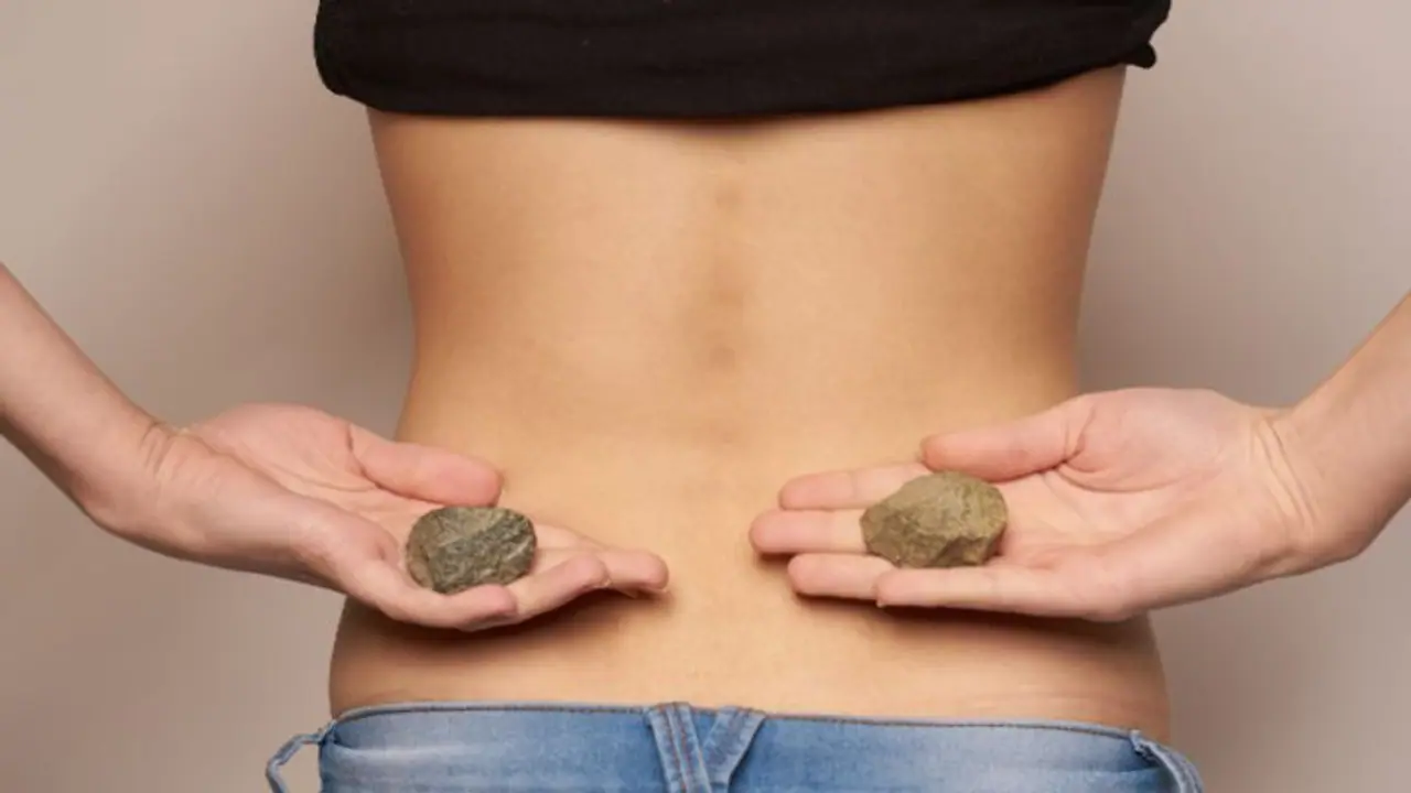Top foods to avoid if you have kidney stones