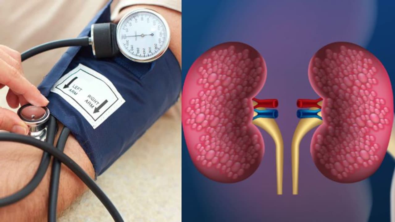 ഉയർന്ന രക്തസമ്മർദ്ദം വൃക്കയുടെ ആരോഗ്യത്തെ ബാധിക്കുന്നത് എങ്ങനെ? ഡോക്ടര് പറയുന്നു... ഉയർന്ന രക്തസമ്മർദ്ദം വൃക്കയുടെ ആരോഗ്യത്തെ ബാധിക്കുന്നത് എങ്ങനെ? ഡോക്ടര് പറയുന്നു...