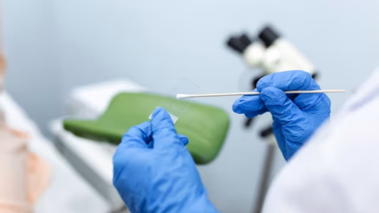 Cervical cancer Cervical cancer