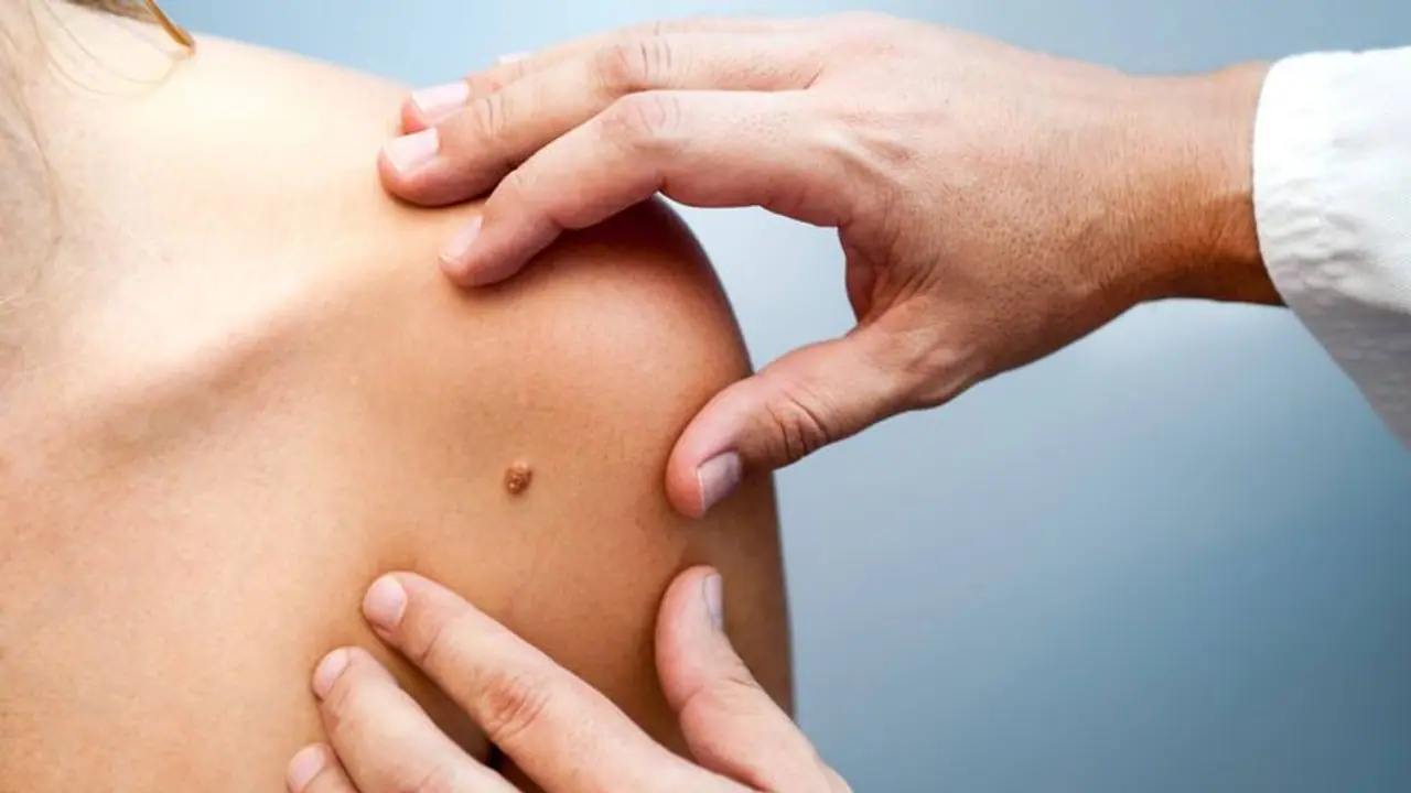 World Cancer Day 2024 : ക്യാൻസർ ; ശരീരം മുൻകൂട്ടി കാണിക്കുന്ന 6 ലക്ഷണങ്ങൾ