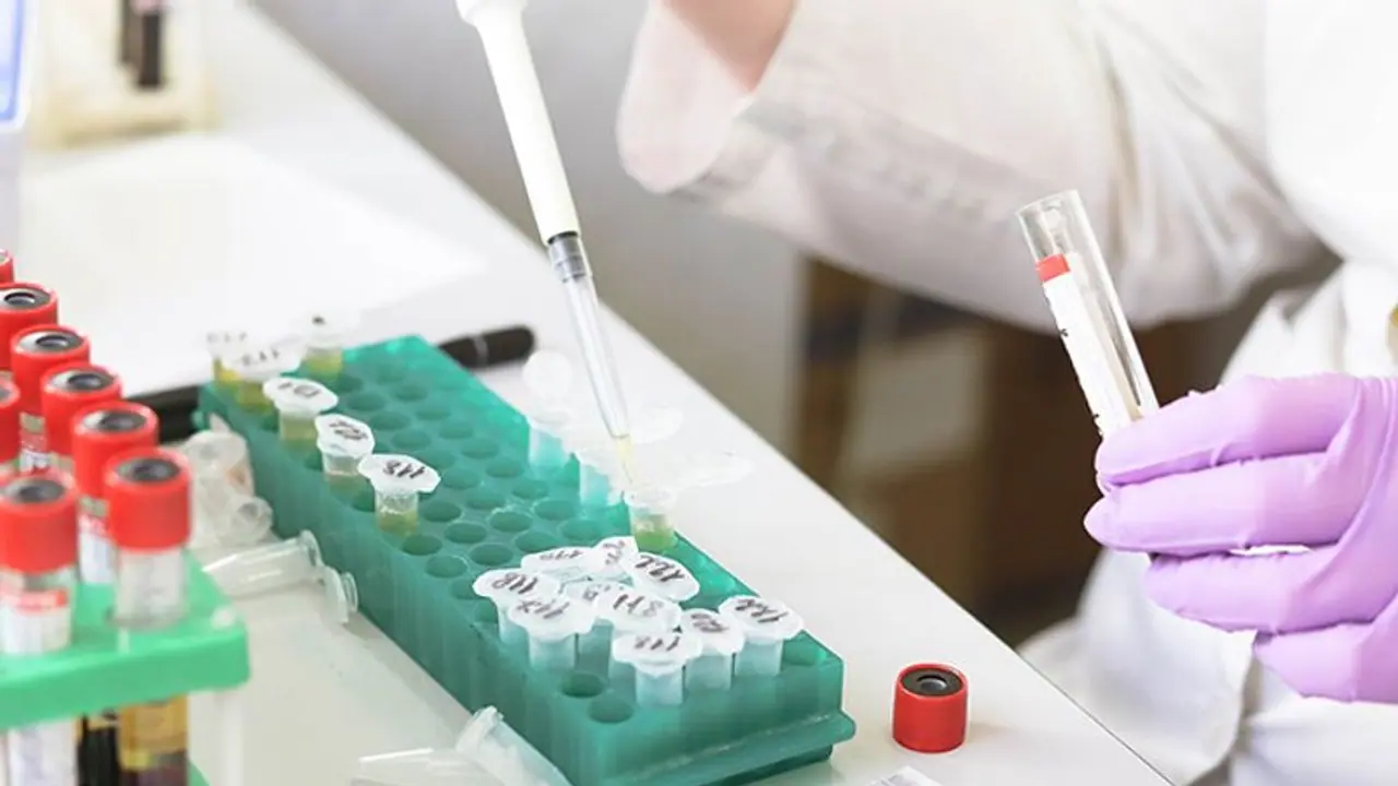 Thymosin Beta 4 and Stroke Research