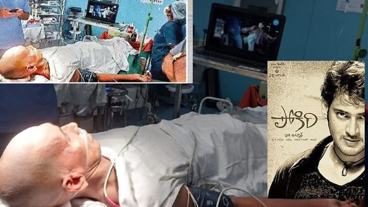 పోకిరి సినిమా చూపిస్తూ.. బ్రెయిన్ ఆపరేషన్ చేసిన వైద్యులు.. పోకిరి సినిమా చూపిస్తూ.. బ్రెయిన్ ఆపరేషన్ చేసిన వైద్యులు..