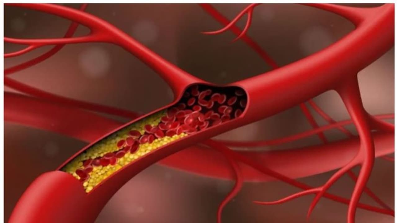 ഇവ കഴിച്ചോളൂ, ഉയർന്ന കൊളസ്ട്രോൾ കുറയ്ക്കാൻ സഹായിക്കും ഇവ കഴിച്ചോളൂ, ഉയർന്ന കൊളസ്ട്രോൾ കുറയ്ക്കാൻ സഹായിക്കും