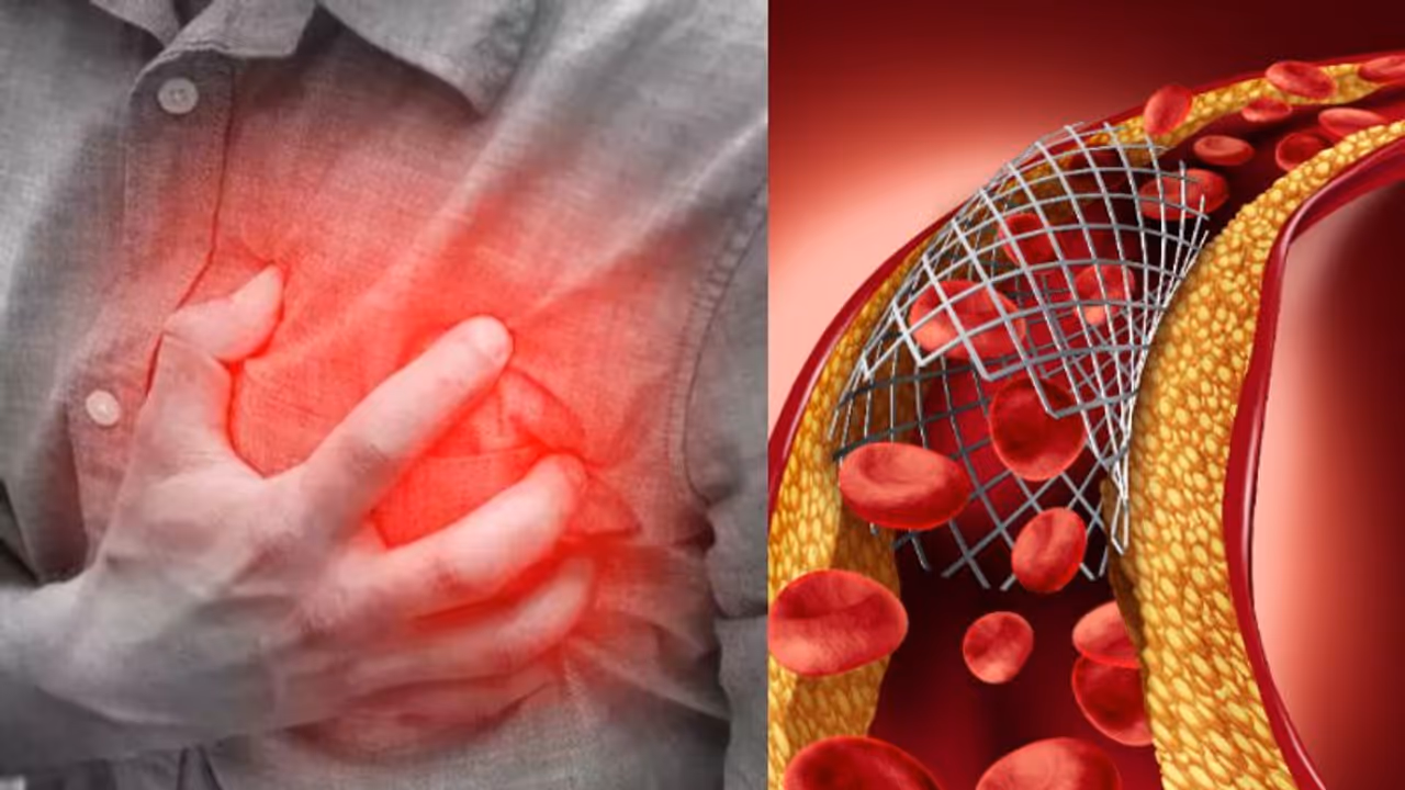 ഈ മത്സ്യം പതിവാക്കൂ, ഉയര്ന്ന കൊളസ്ട്രോളിനെ കുറയ്ക്കാം... ഈ മത്സ്യം പതിവാക്കൂ, ഉയര്ന്ന കൊളസ്ട്രോളിനെ കുറയ്ക്കാം...