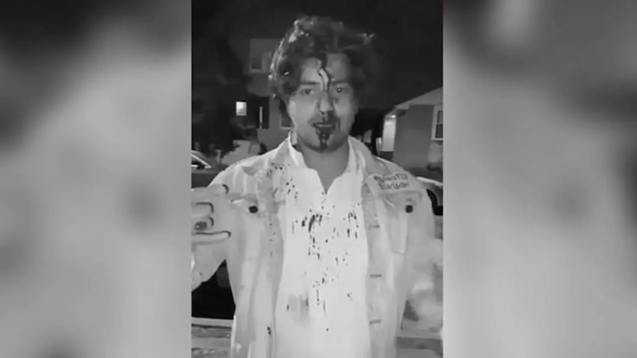 ப்ளீஸ் காப்பாத்துங்க... அமெரிக்காவில் முகத்தில் வழியும் ரத்தத்துடன் உதவி கேட்கும் இந்திய மாணவர்!