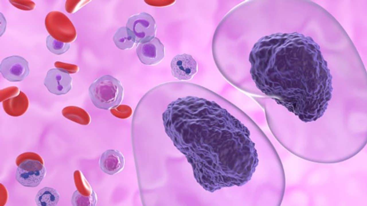 ക്യാൻസർ കേസുകള്‍ വർദ്ധിച്ചുവരുന്നതിന് പിന്നിലെ ആറ് കാരണങ്ങള്‍...