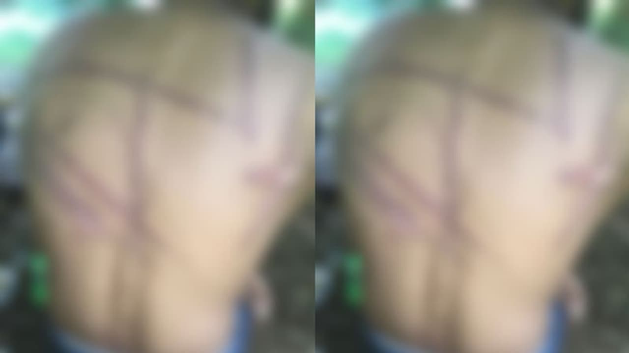  തീക്കനൽ വാരിയിട്ട് രഹസ്യഭാഗത്ത് പൊള്ളിച്ചു; കാപ്പ കേസ് പ്രതിയെ മൃ​ഗീയമായി കൊല്ലാൻ ശ്രമിച്ച പ്രതികൾ അറസ്റ്റിൽ