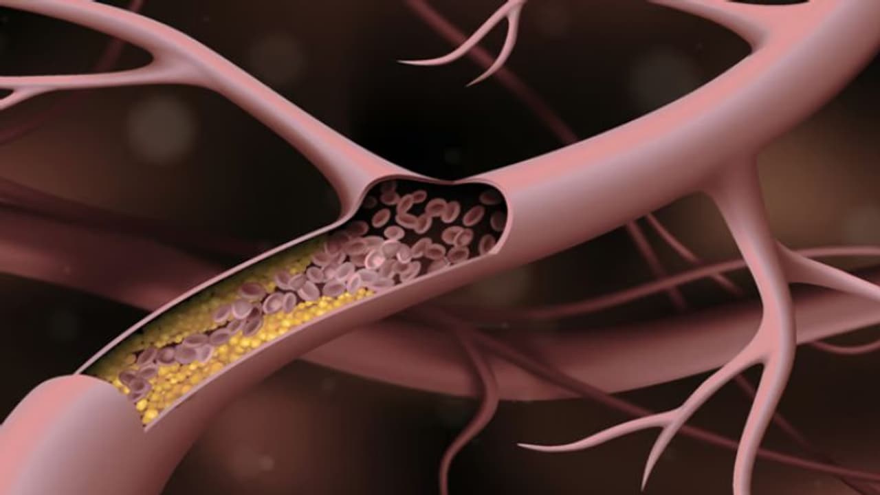 Health Tips: കൊളസ്ട്രോള്‍ കൂടുതലാണോ? കുറയ്ക്കാനായി ചെയ്യേണ്ട ഏഴ് കാര്യങ്ങള്‍...