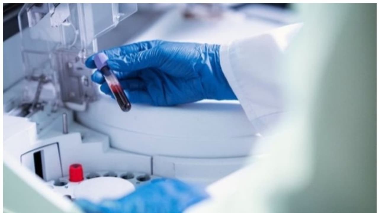 ക്യാൻസർ ചികിത്സയിൽ ഇത് പുതുവിപ്ലവം; ഇന്ത്യയിൽ വികസിപ്പിച്ച 'കാർ ടി' ചികിത്സയിലൂടെ ആദ്യ രോഗി ക്യാൻസർ മുക്തനായി