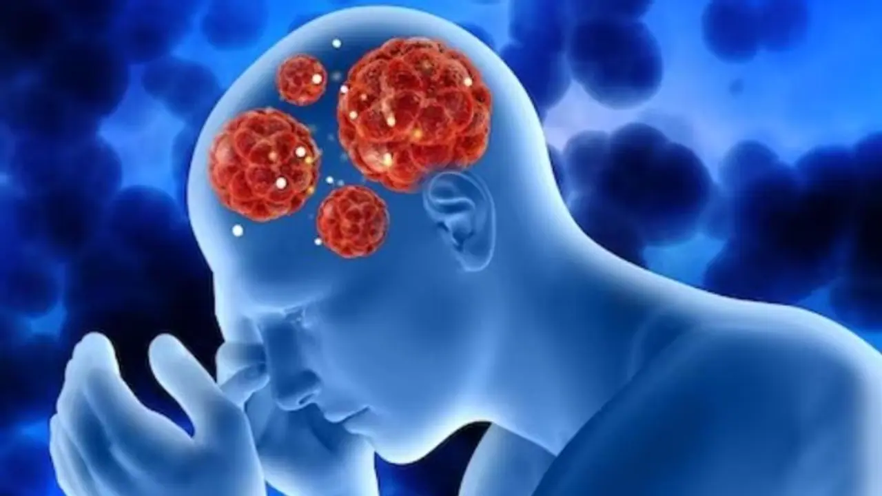 What is ischemic cerebrovascular accident stroke of brain? The disease Mithun Chakraborty is diagnosed with? What is ischemic cerebrovascular accident stroke of brain? The disease Mithun Chakraborty is diagnosed with?