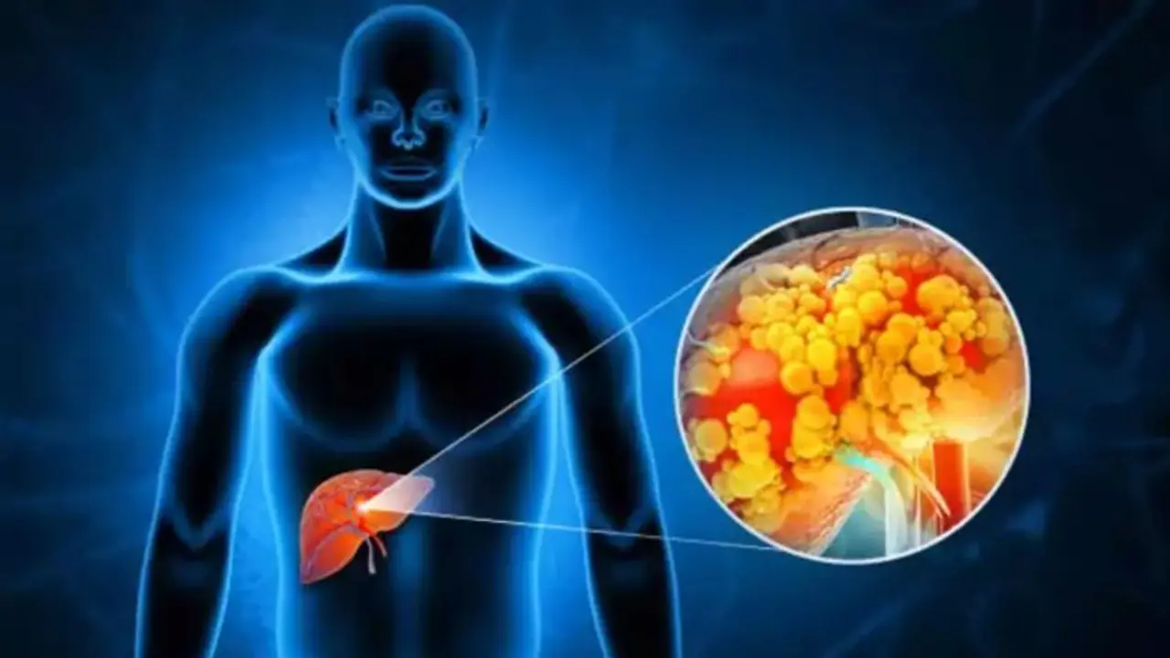 ലിവര് ക്യാൻസർ; ശരീരം മുൻകൂട്ടി കാണിക്കുന്ന ഈ സൂചനകളെ അവഗണിക്കരുത്... ലിവര് ക്യാൻസർ; ശരീരം മുൻകൂട്ടി കാണിക്കുന്ന ഈ സൂചനകളെ അവഗണിക്കരുത്...