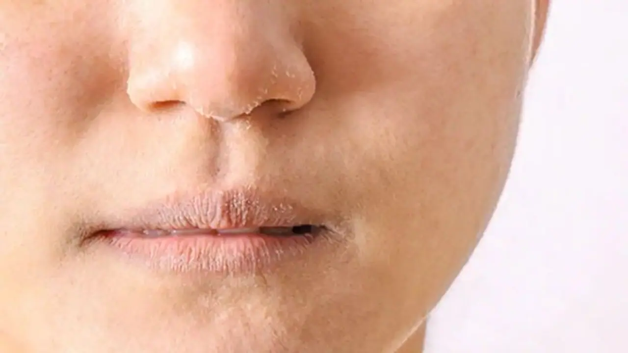 dry skin rashes dry skin rashes