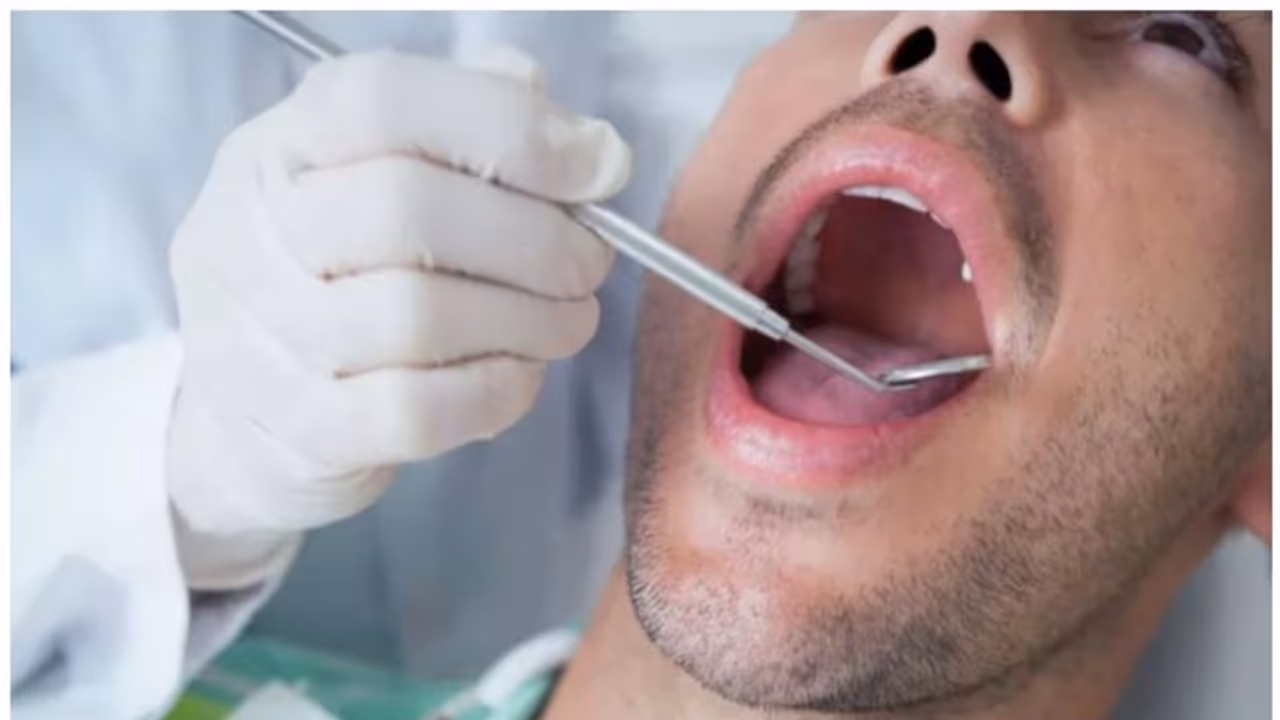 വായിലെ ക്യാൻസർ ; ഈ അഞ്ച് ലക്ഷണങ്ങൾ അവഗണിക്കരുത് വായിലെ ക്യാൻസർ ; ഈ അഞ്ച് ലക്ഷണങ്ങൾ അവഗണിക്കരുത്