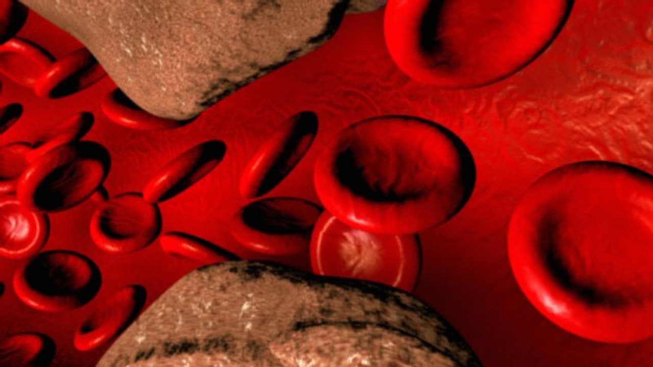 കൊളസ്ട്രോള്‍ കൂടുതലാണോ? ദിവസവും ഡയറ്റില്‍ ഉള്‍പ്പെടുത്താം ഈ പാനീയം... 