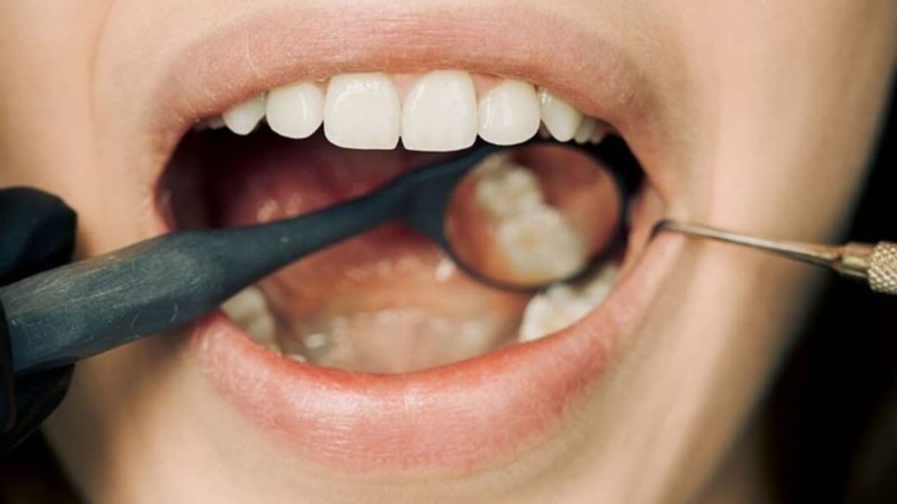 ഞെട്ടിക്കുന്ന പഠനം! പുകയില ഉപയോഗമില്ല, മദ്യപാന ശീലവുമില്ല; പക്ഷെ ഇവരിലും ഓറൽ കാൻസര് കേസുകൾ ഗണ്യമായി കൂടുന്നു ഞെട്ടിക്കുന്ന പഠനം! പുകയില ഉപയോഗമില്ല, മദ്യപാന ശീലവുമില്ല; പക്ഷെ ഇവരിലും ഓറൽ കാൻസര് കേസുകൾ ഗണ്യമായി കൂടുന്നു