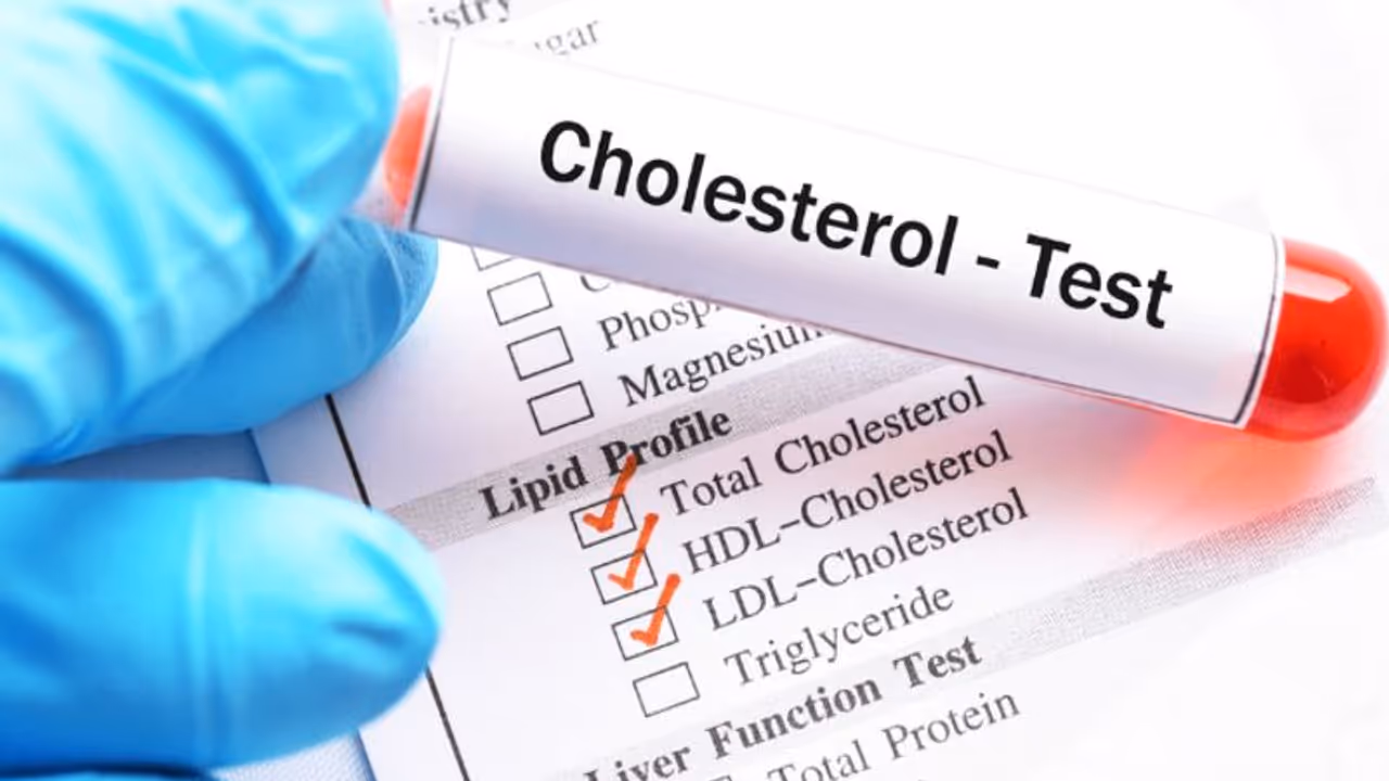 നല്ല കൊളസ്ട്രോൾ കൂട്ടാൻ സഹായിക്കുന്ന അഞ്ച് പഴങ്ങൾ നല്ല കൊളസ്ട്രോൾ കൂട്ടാൻ സഹായിക്കുന്ന അഞ്ച് പഴങ്ങൾ