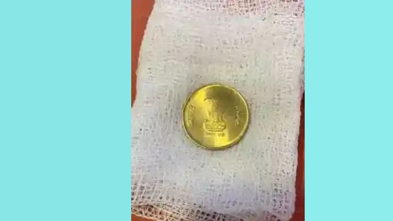 കളിക്കുന്നതിനിടെ ഏഴു വയസ്സുകാരൻ വിഴുങ്ങിയത് അഞ്ചു രൂപ നാണയം: പുറത്തെടുത്തത് ഇങ്ങനെ...