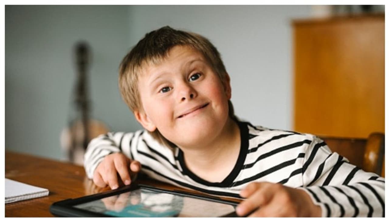 രോഗങ്ങള്‍ക്കും മനുഷ്യനോളം പ്രായം; 5,000 വർഷം പഴക്കമുള്ള ഡിഎൻഎകളിലും ഡൗൺ സിൻഡ്രോമിന്‍റെ ആറ് കേസുകൾ !