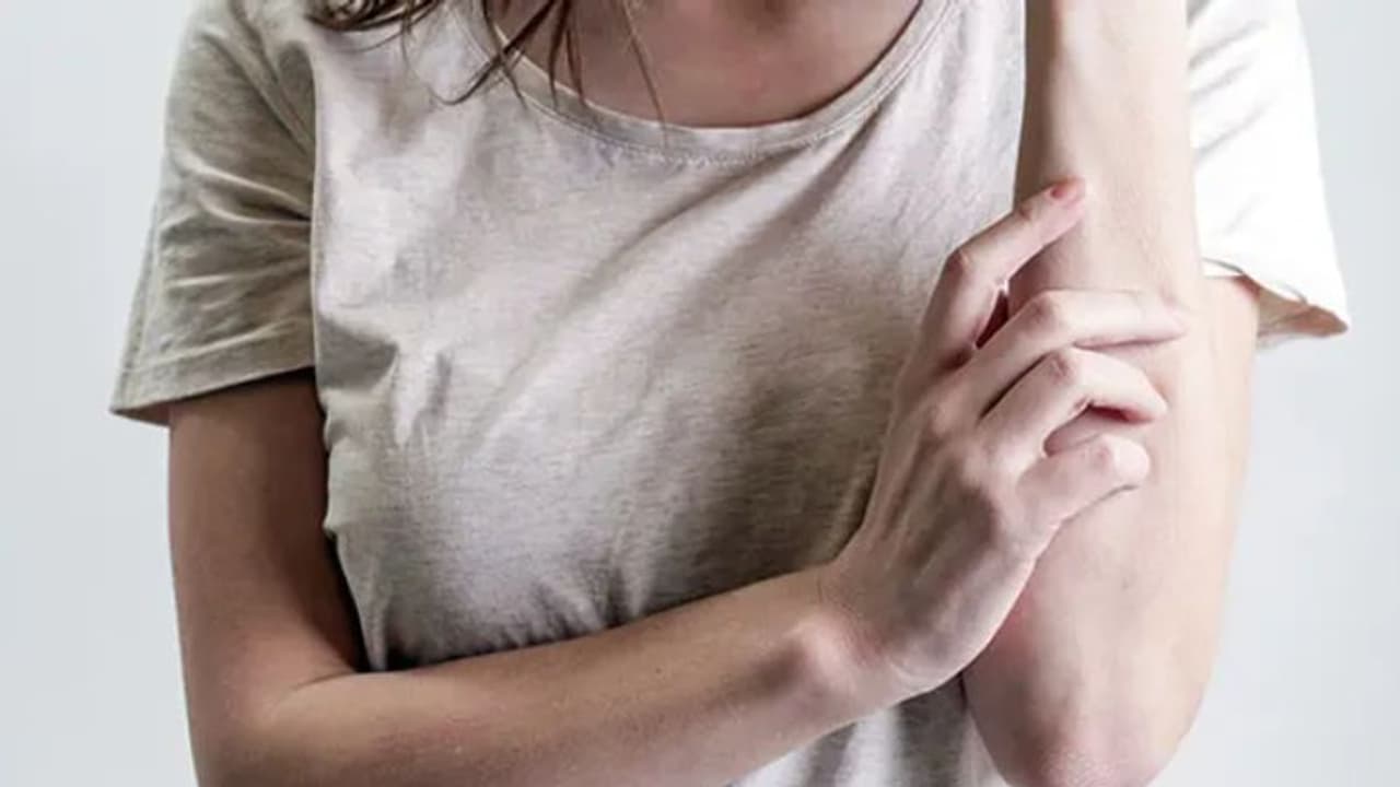 കടുത്ത പനി, തലവേദന, തൊലിപ്പുറത്ത് ചുവന്ന കുമിളകള്; വേനൽക്കാലത്തെ ഈ ലക്ഷണങ്ങളെ നിസാരമായി കാണേണ്ട... കടുത്ത പനി, തലവേദന, തൊലിപ്പുറത്ത് ചുവന്ന കുമിളകള്; വേനൽക്കാലത്തെ ഈ ലക്ഷണങ്ങളെ നിസാരമായി കാണേണ്ട...