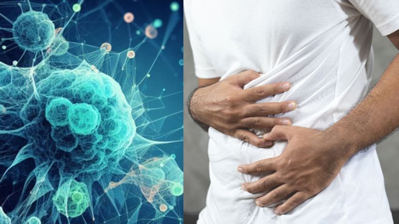 What are the causes and symptoms of stomach cancer? Early diagnosis can help with the cure