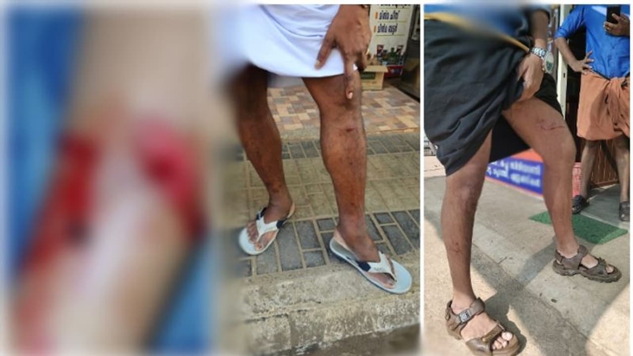 ഇവിടെ മനുഷ്യന് ജീവിക്കണ്ടേ..! 10 വയസുകാരനെയടക്കം കടിച്ച് പറിച്ച് ഒരു തെരുവ് നായ, വീട്ടിൽ പോലും സമാധാനമില്ല