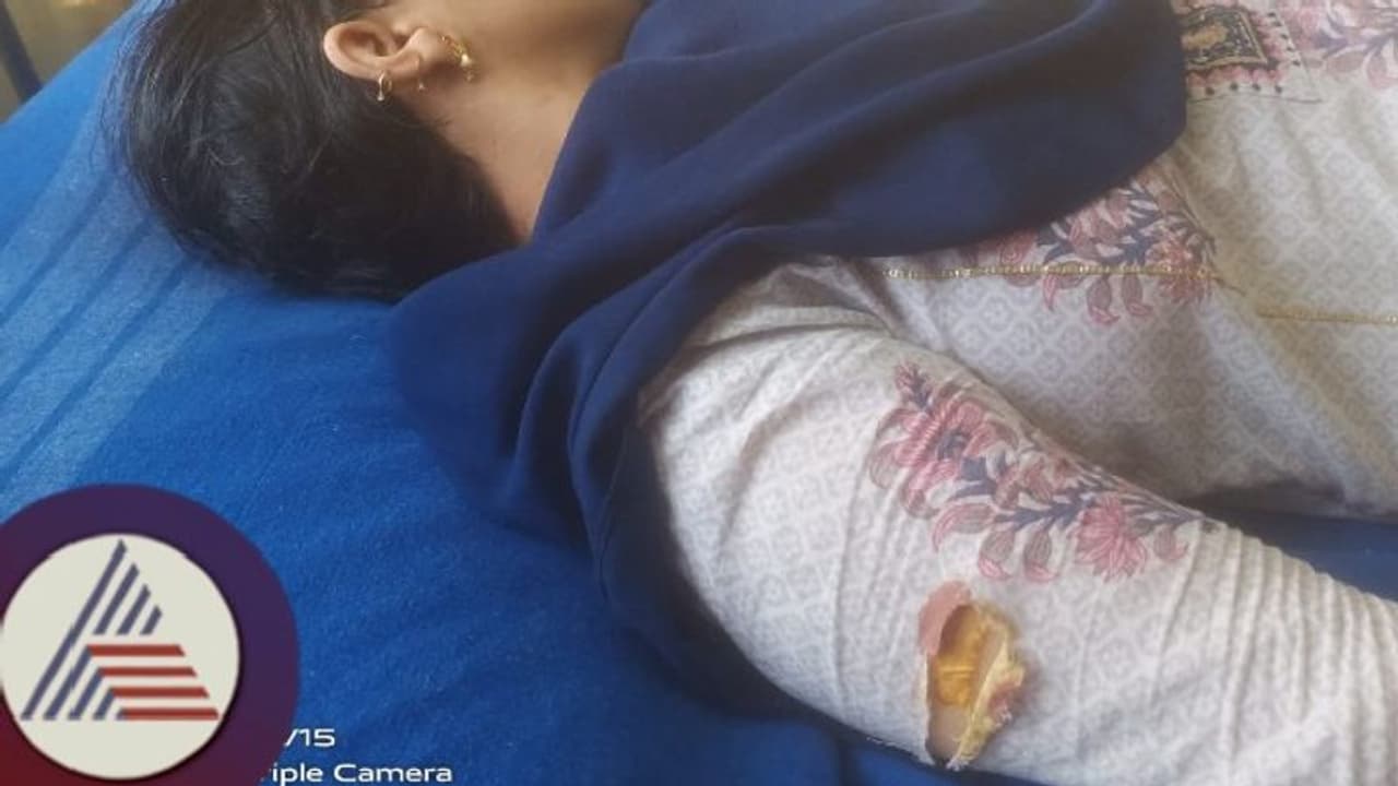 ಬೇರೊಬ್ಬನ ಜೊತೆ ಗರ್ಲ್ಫ್ರೆಂಡ್ ಮದುವೆ, ಆಕೆಯ ಕೈಯನ್ನೇ ಕತ್ತರಿಸಿದ ಪಾಗಲ್ ಪ್ರೇಮಿ! ಬೇರೊಬ್ಬನ ಜೊತೆ ಗರ್ಲ್ಫ್ರೆಂಡ್ ಮದುವೆ, ಆಕೆಯ ಕೈಯನ್ನೇ ಕತ್ತರಿಸಿದ ಪಾಗಲ್ ಪ್ರೇಮಿ!