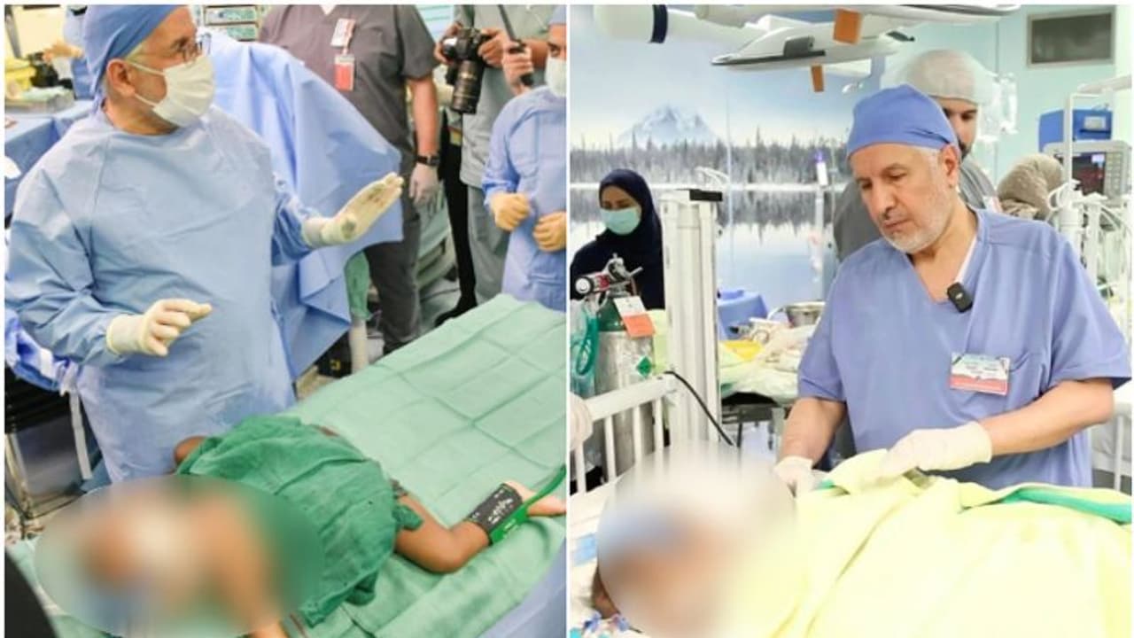 രണ്ടാണെങ്കിലും നമ്മളൊന്നല്ലേ; ഒമ്പത് ഘട്ടങ്ങൾ, പതിനാറര മണിക്കൂര് നീണ്ട ശസ്ത്രക്രിയ, ഹസ്നയും ഹസീനയും രണ്ടായി രണ്ടാണെങ്കിലും നമ്മളൊന്നല്ലേ; ഒമ്പത് ഘട്ടങ്ങൾ, പതിനാറര മണിക്കൂര് നീണ്ട ശസ്ത്രക്രിയ, ഹസ്നയും ഹസീനയും രണ്ടായി