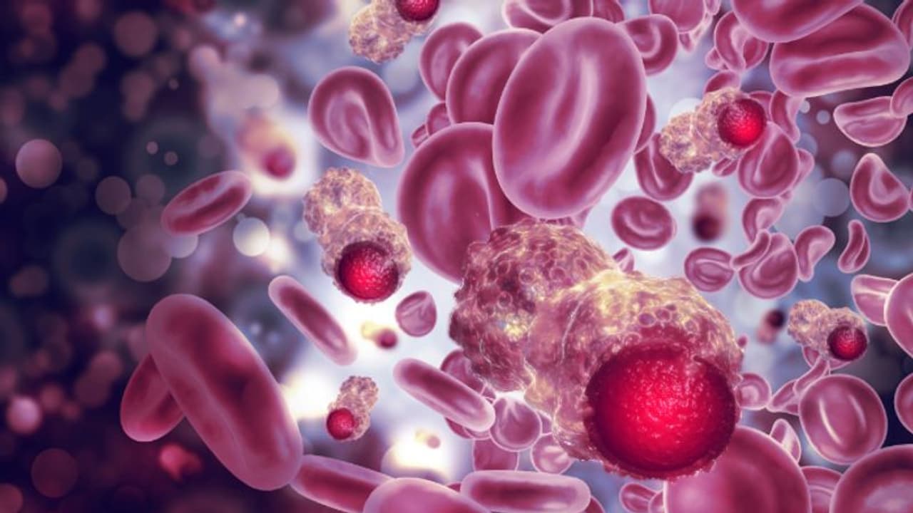 ബ്ലഡ് ക്യാൻസർ; ഈ പ്രാരംഭ ലക്ഷണങ്ങളെ അവഗണിക്കരുതേ... ബ്ലഡ് ക്യാൻസർ; ഈ പ്രാരംഭ ലക്ഷണങ്ങളെ അവഗണിക്കരുതേ...