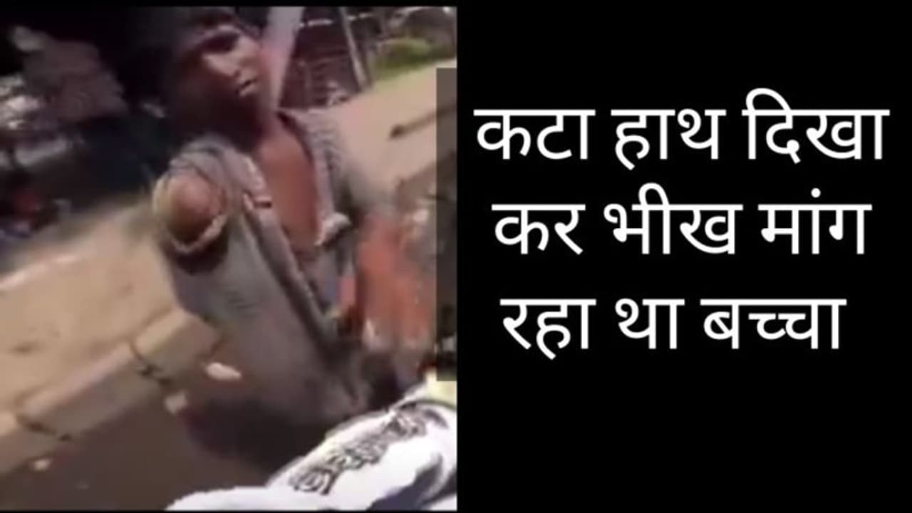 कटा हाथ दिखाकर भीख मांग रहा था बच्चा! बाइक सवार ने खोली पोल