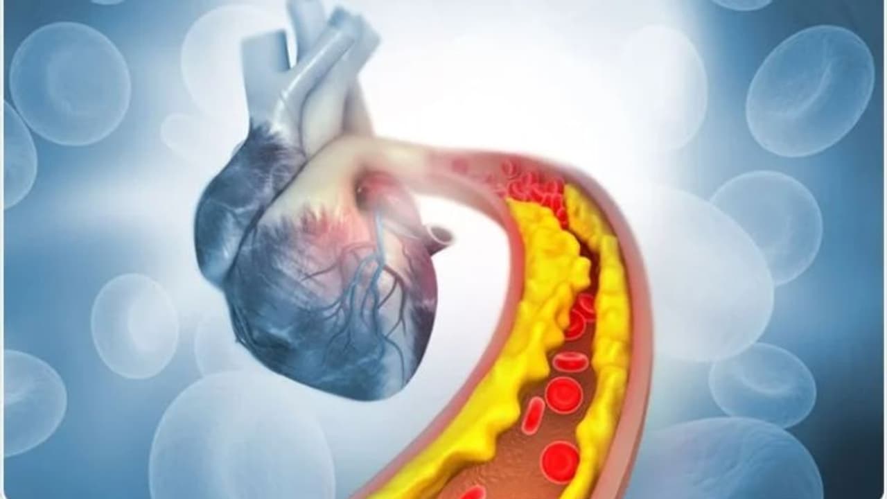 ഈ പത്ത് ഭക്ഷണങ്ങള് പതിവാക്കൂ, ശരീരത്തില് ചീത്ത കൊളസ്ട്രോൾ അടിയുന്നത് തടയാം... ഈ പത്ത് ഭക്ഷണങ്ങള് പതിവാക്കൂ, ശരീരത്തില് ചീത്ത കൊളസ്ട്രോൾ അടിയുന്നത് തടയാം...