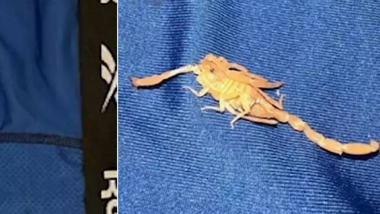 ആഡംബര റിസോർട്ടിലെത്തിയത് അടിച്ചുപൊളിക്കാൻ, സ്വകാര്യഭാഗത്ത് തേൾ കുത്തി, കേസ് കൊടുത്ത് യുവാവ് ആഡംബര റിസോർട്ടിലെത്തിയത് അടിച്ചുപൊളിക്കാൻ, സ്വകാര്യഭാഗത്ത് തേൾ കുത്തി, കേസ് കൊടുത്ത് യുവാവ്