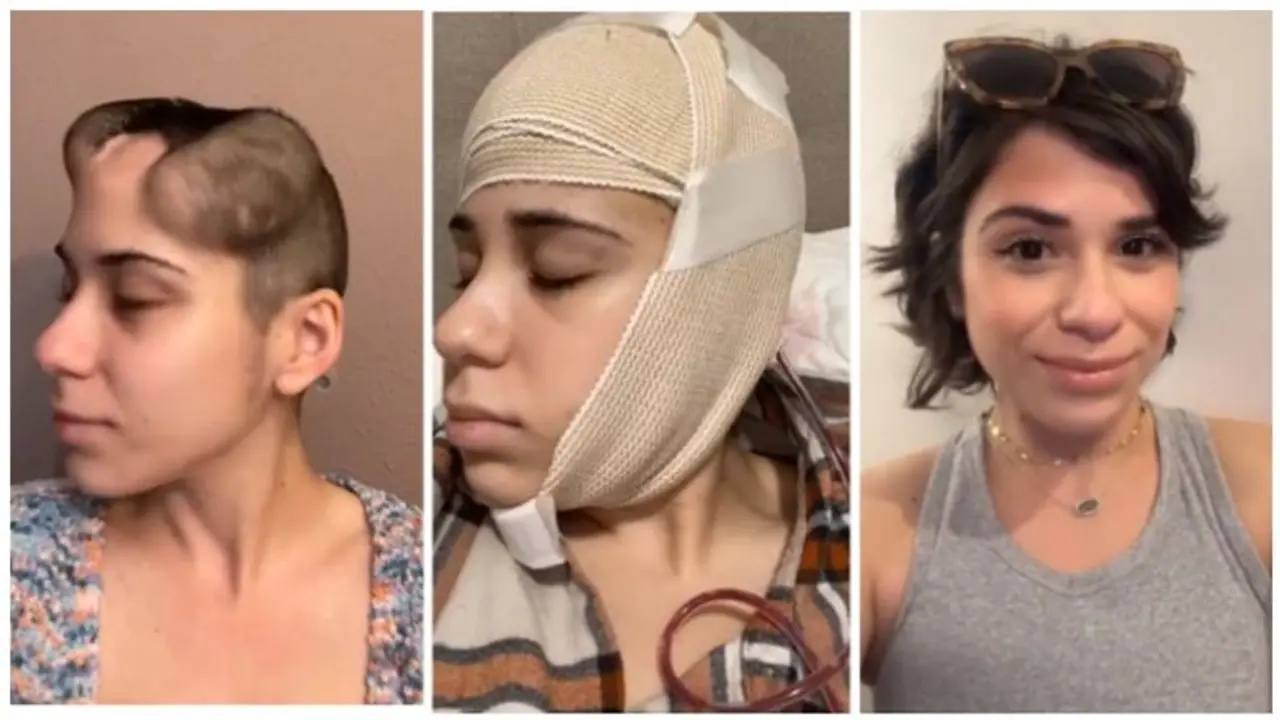 महिला दिवस में कैंसर पीड़ित इस महिला की बहादुरी का VIDEO छू लेगा मन को... महिला दिवस में कैंसर पीड़ित इस महिला की बहादुरी का VIDEO छू लेगा मन को...