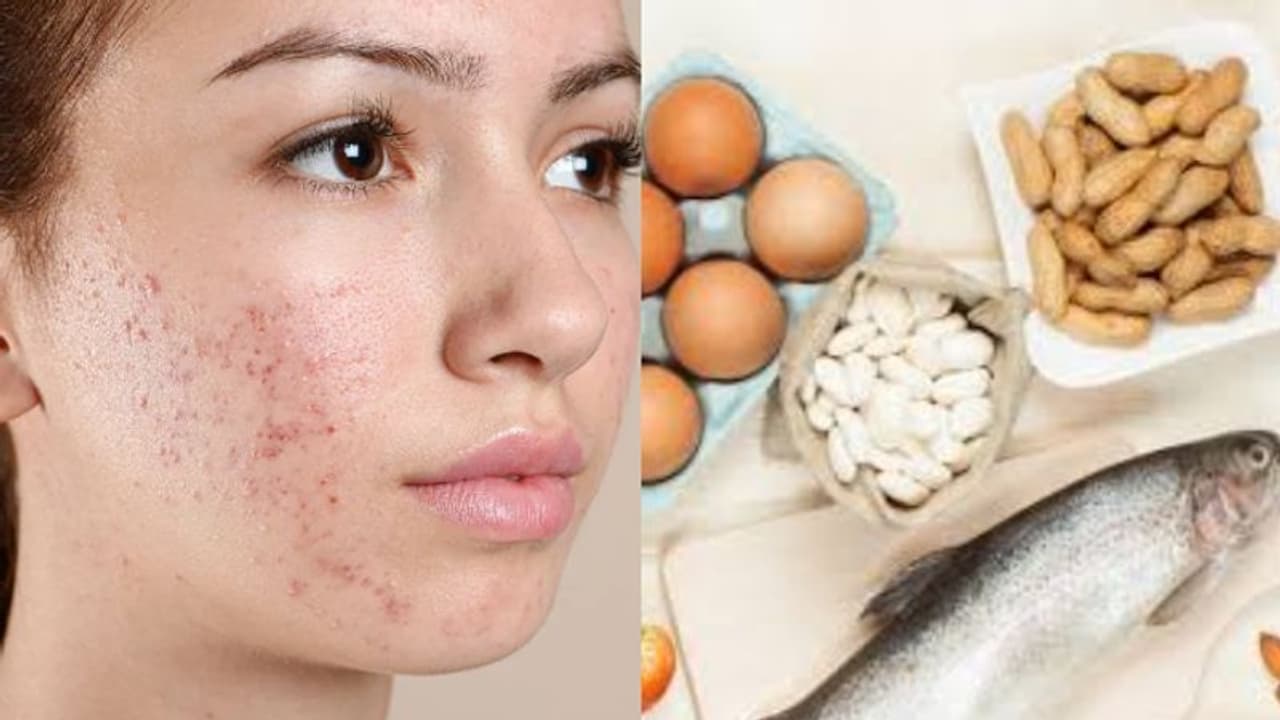 Health Tips: ശ്രദ്ധിക്കൂ, ഈ ഭക്ഷണങ്ങൾ ചിലരില്‍ സ്കിന്‍ അലർജിക്ക് കാരണമായേക്കാം... 