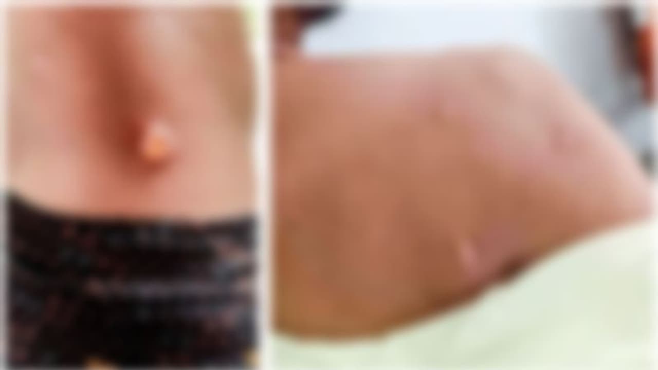 കൊടും ചൂട്; മുറ്റത്ത് തണലിനായി നെറ്റ് വിരിച്ചു കെട്ടുന്നതിനിടെ മൂന്നുപേർക്ക് സൂര്യാതപമേറ്റു, സംഭവം മലപ്പുറത്ത് കൊടും ചൂട്; മുറ്റത്ത് തണലിനായി നെറ്റ് വിരിച്ചു കെട്ടുന്നതിനിടെ മൂന്നുപേർക്ക് സൂര്യാതപമേറ്റു, സംഭവം മലപ്പുറത്ത്