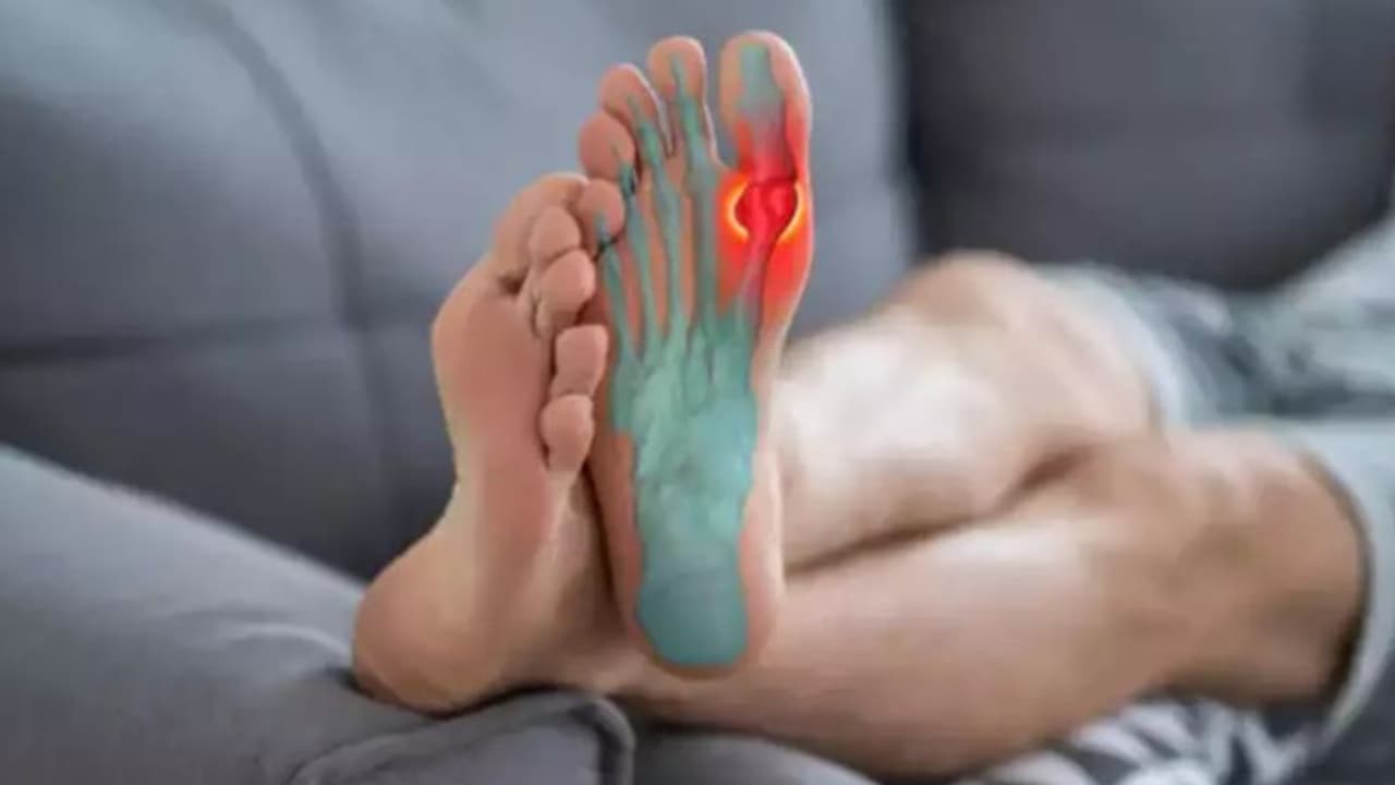 കാലുകളുടെ പത്തിക്ക് വല്ലാത്ത പുകച്ചിലും നീറ്റലും; ഈ ലക്ഷണങ്ങളെ ഒരിക്കലും അവഗണിക്കരുത്, യൂറിക് ആസിഡ് കൂടിയതാകാം